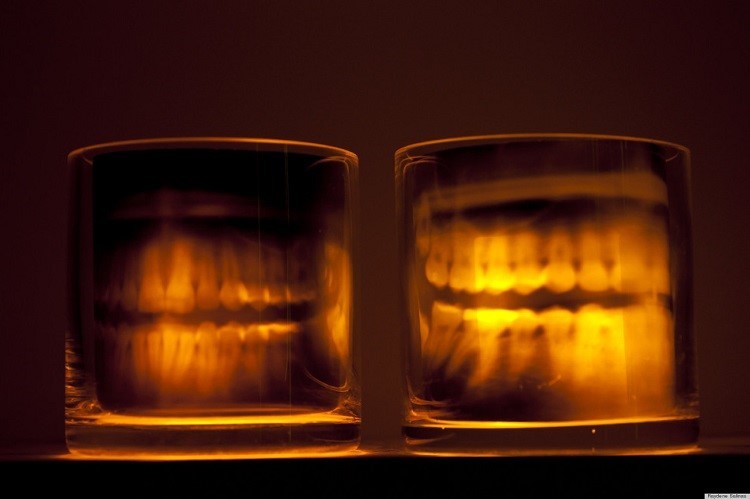 lamparas vela radiografias dientes terror