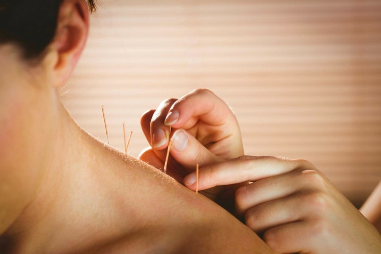 acupuntura para adelgazar espalda