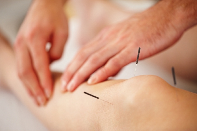pierna tratamiento acupuntura general