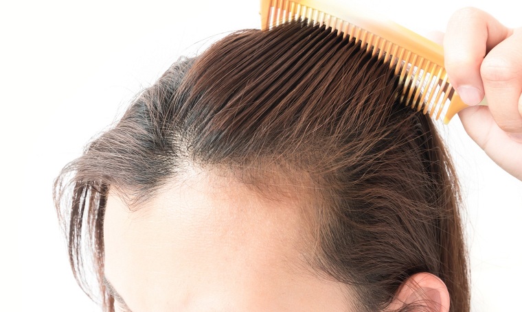 causas de la caida del cabello mejorar-pelo