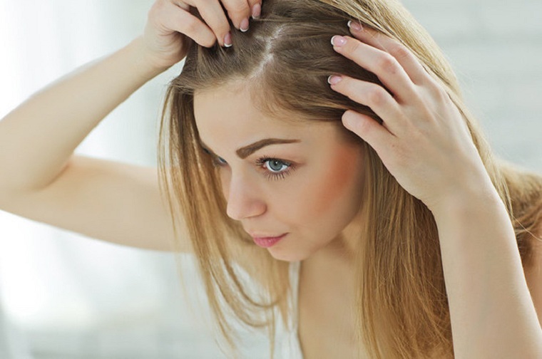 mujer-sufrir-perdida-cabello-razon