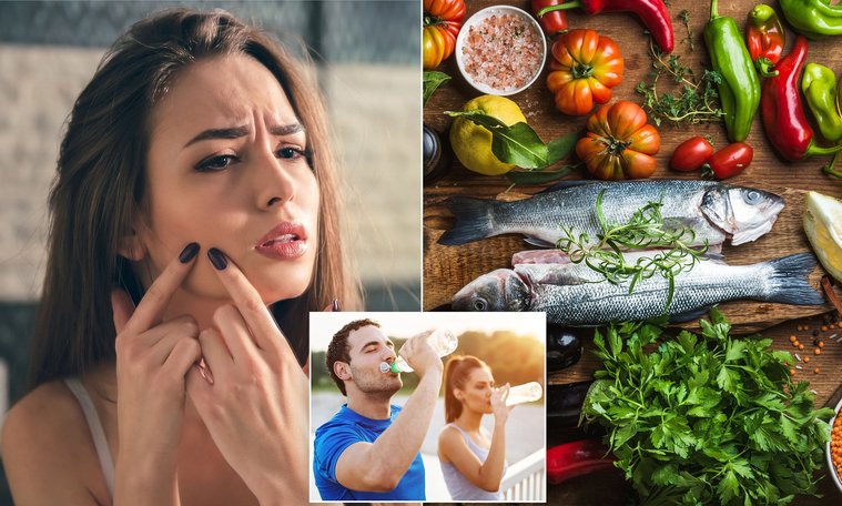 Espinillas alimentacion para prevenir