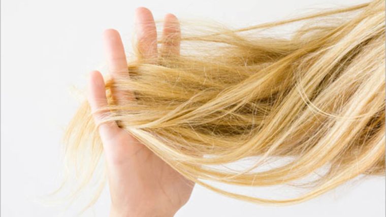 alopecia cabello