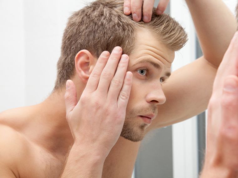 alopecia comienzo