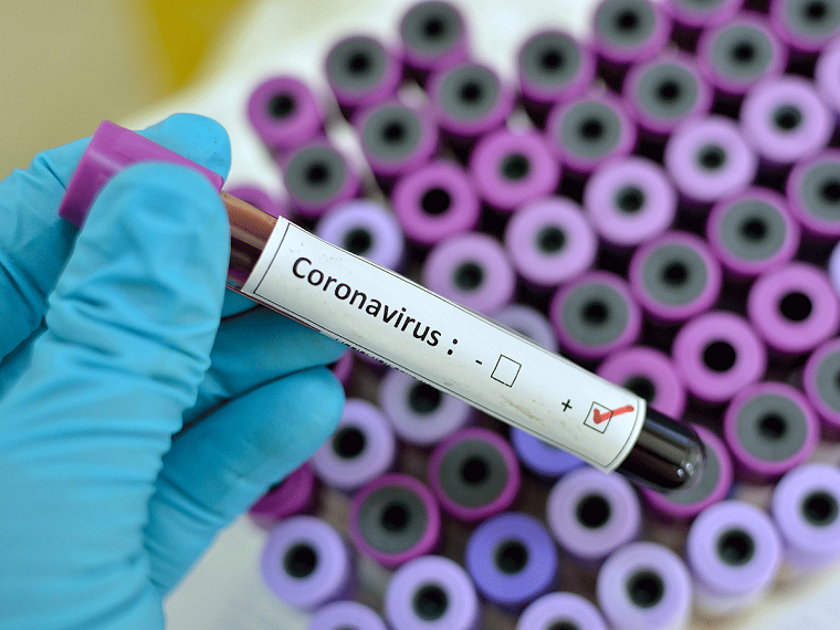 mitos de coronavirus-populares-internet