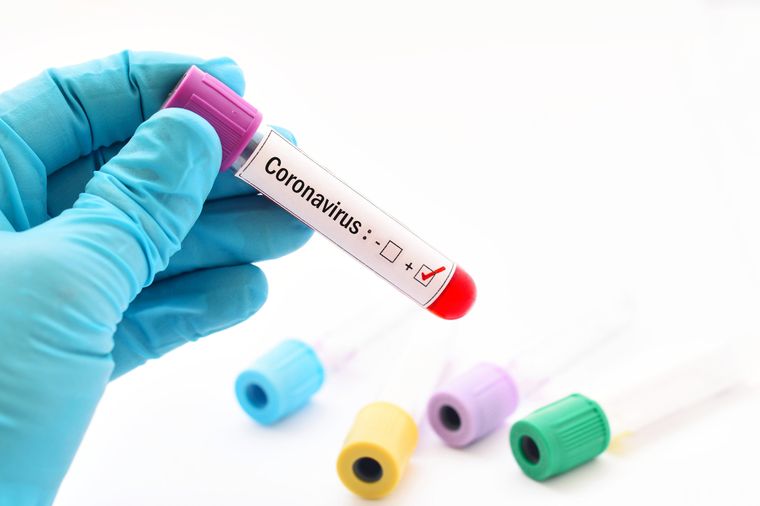 coronavirus pruebas