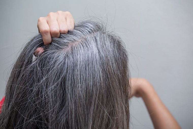 Cabello-gris-razones-perder-color