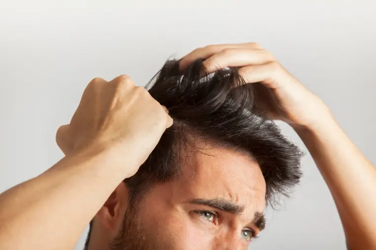 caída de cabello hombres