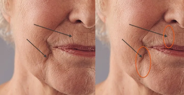 masajes para la cara para mujeres despues de los 60 y 60 años