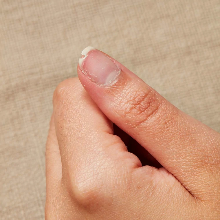 Tener cuidado con las uñas ya que suelen ser muy frágiles